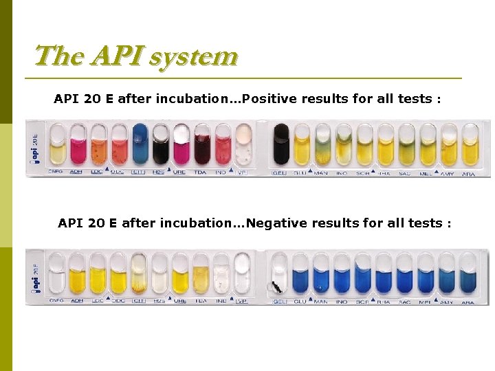 The API system API 20 E after incubation…Positive results for all tests : API