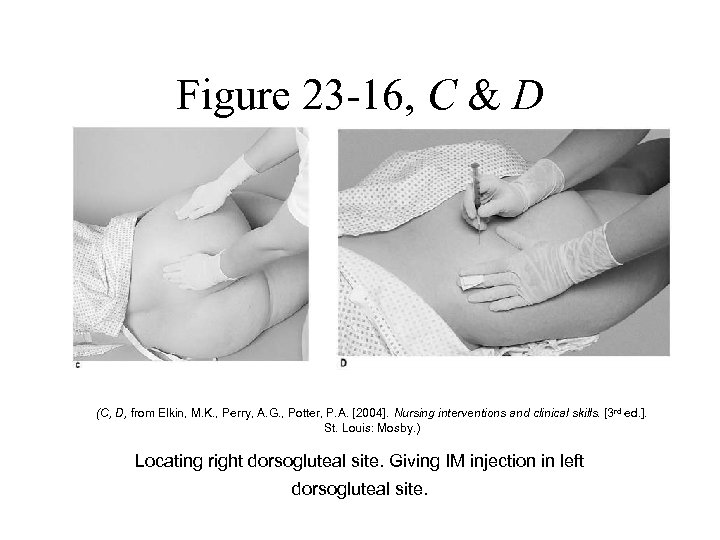 Figure 23 -16, C & D (C, D, from Elkin, M. K. , Perry,