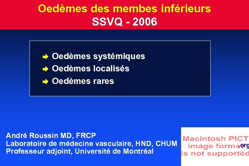 Oedèmes des membes inférieurs SSVQ - 2006 è è è Oedèmes systémiques Oedèmes localisés