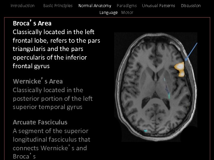 Introduction Basic Principles Normal Anatomy Paradigms Language Motor _ Broca’s Area I Classically located