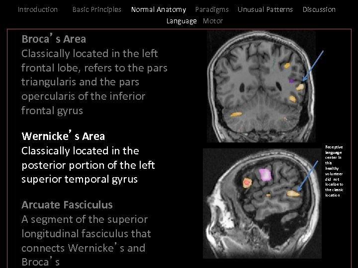 Introduction Basic Principles Normal Anatomy Paradigms Language Motor Unusual Patterns Discussion _ Broca’s Area