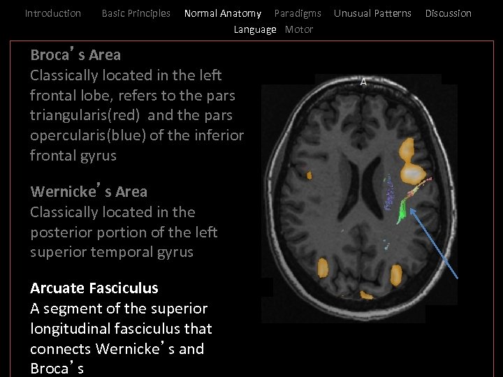 Introduction Basic Principles Normal Anatomy Paradigms Language Motor _ Broca’s Area I Classically located