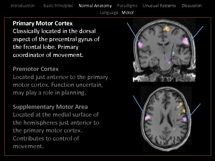 Introduction Basic Principles Normal Anatomy Paradigms Language Motor _ Primary Motor Cortex I Classically