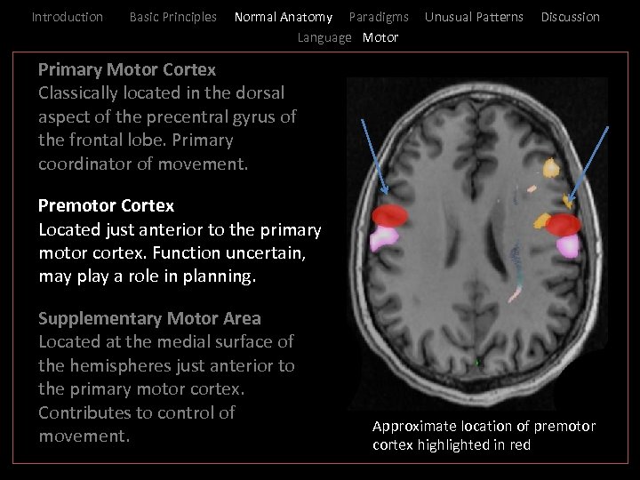 Introduction Basic Principles Normal Anatomy Paradigms Language Motor Unusual Patterns Discussion _ Primary Motor