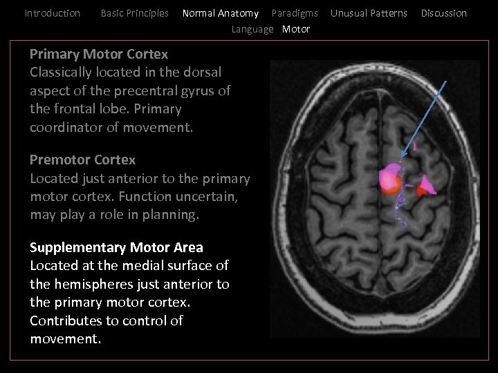 Introduction Basic Principles Normal Anatomy Paradigms Language Motor _ Primary Motor Cortex I Classically