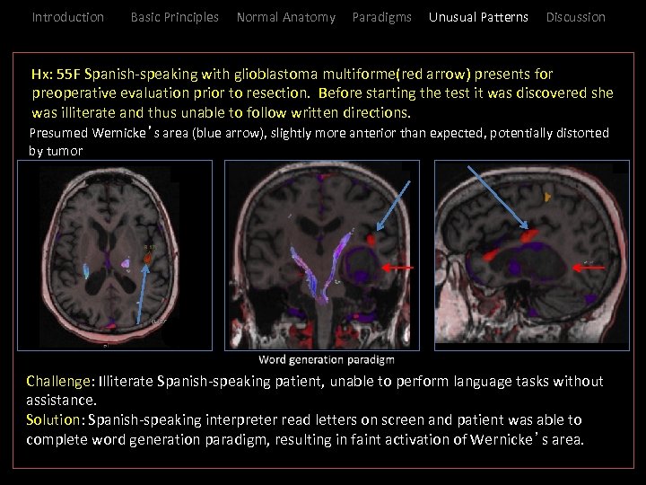 Introduction Basic Principles Normal Anatomy Paradigms Unusual Patterns Discussion _Hx: 55 F Spanish-speaking with