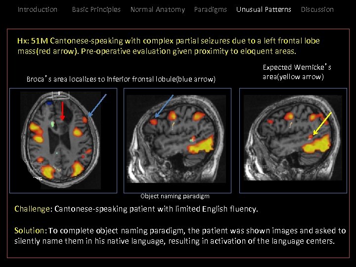 Introduction Basic Principles Normal Anatomy Paradigms Unusual Patterns Discussion _Hx: 51 M Cantonese-speaking with