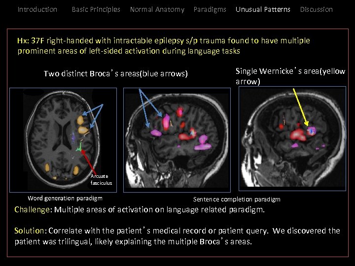 Introduction Basic Principles Normal Anatomy Paradigms Unusual Patterns Discussion _Hx: 37 F right-handed with