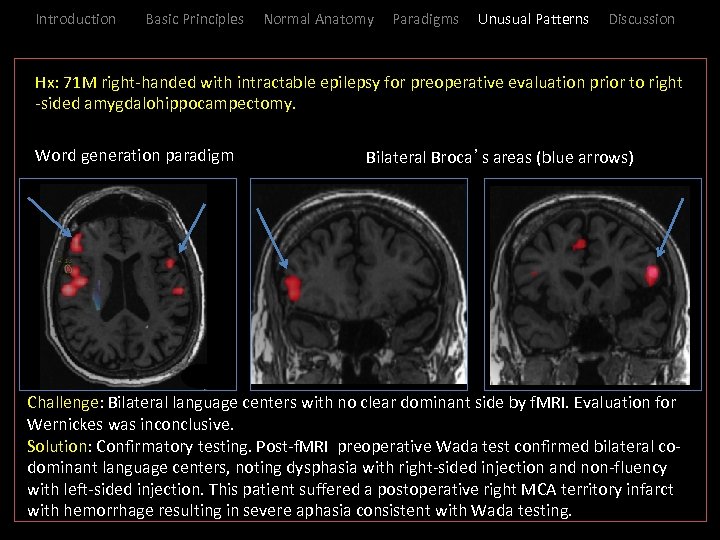 Introduction Basic Principles Normal Anatomy Paradigms Unusual Patterns Discussion _Hx: 71 M right-handed with