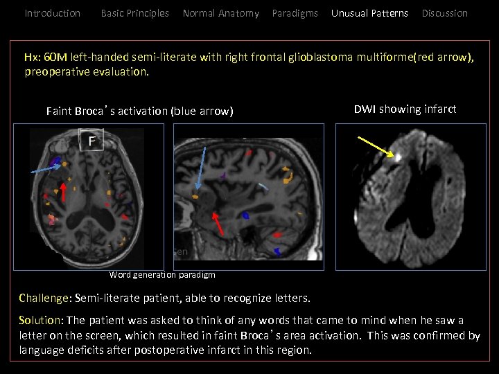 Introduction Basic Principles Normal Anatomy Paradigms Unusual Patterns Discussion Hx: _( 60 M left-handed