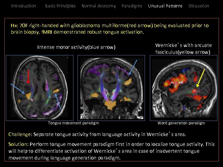 Introduction Basic Principles Normal Anatomy Paradigms Unusual Patterns Discussion _Hx: 70 F right-handed with