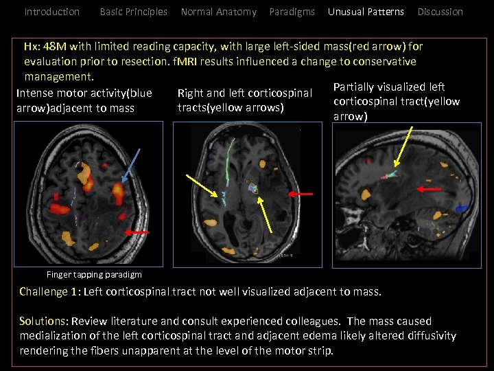 Introduction Basic Principles Normal Anatomy Paradigms Unusual Patterns Discussion _Hx: 48 M with limited