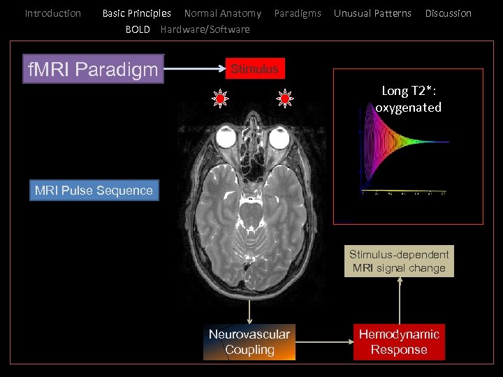 Introduction _ Basic Principles Normal Anatomy BOLD Hardware/Software f. MRI Paradigms Unusual Patterns Discussion