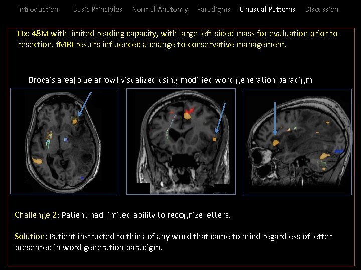 Introduction Basic Principles Normal Anatomy Paradigms Unusual Patterns Discussion large left-sided mass for evaluation