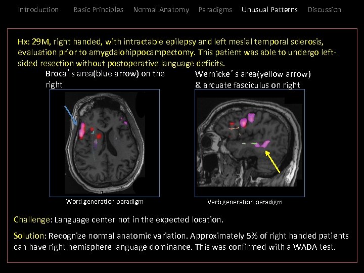 Introduction Basic Principles Normal Anatomy Paradigms Unusual Patterns Discussion _Hx: 29 M, right handed,