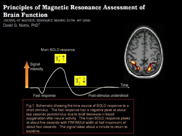 Main BOLD response Fig. 1: Schematic showing the time course of BOLD response to