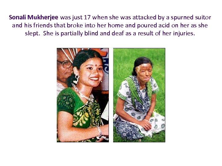 Sonali Mukherjee was just 17 when she was attacked by a spurned suitor and