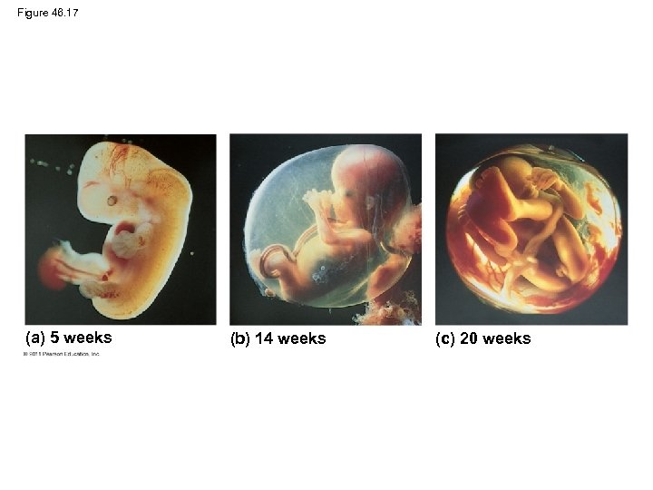 Figure 46. 17 (a) 5 weeks (b) 14 weeks (c) 20 weeks 