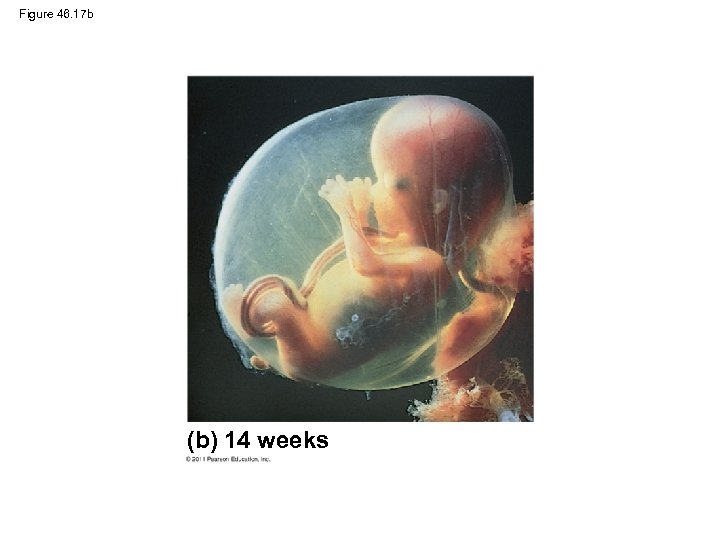 Figure 46. 17 b (b) 14 weeks 