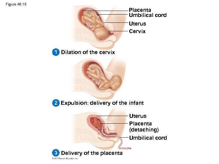 Figure 46. 19 Placenta Umbilical cord Uterus Cervix 1 Dilation of the cervix 2