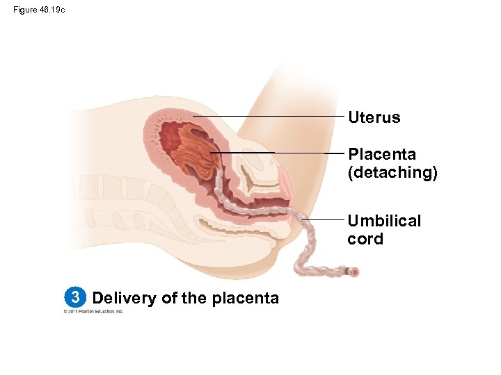 Figure 46. 19 c Uterus Placenta (detaching) Umbilical cord 3 Delivery of the placenta