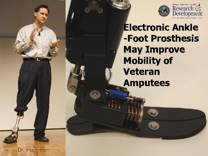 Electronic Ankle -Foot Prosthesis May Improve Mobility of Veteran Amputees 