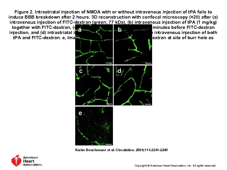Figure 2. Intrastriatal injection of NMDA with or without intravenous injection of t. PA