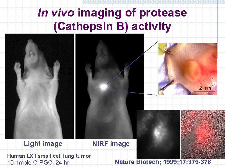 In vivo imaging of protease (Cathepsin B) activity 2 mm Light image Human LX