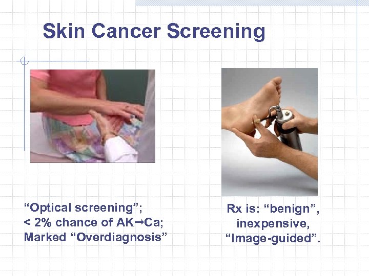 Skin Cancer Screening “Optical screening”; < 2% chance of AK 4 Ca; Marked “Overdiagnosis”