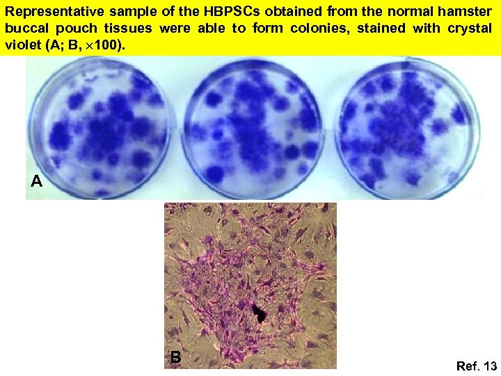 Representative sample of the HBPSCs obtained from the normal hamster buccal pouch tissues were