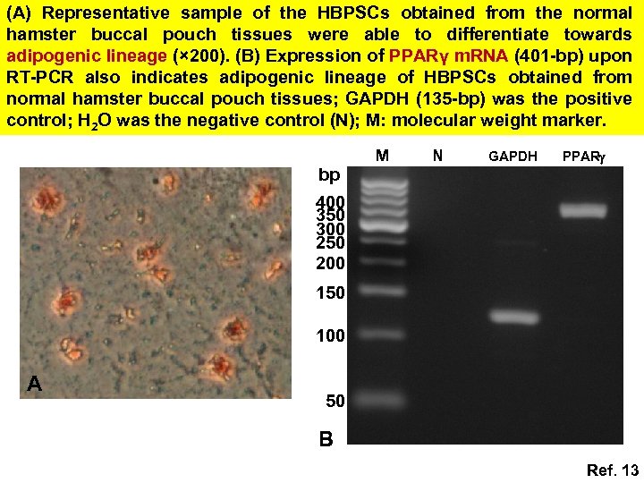 (A) Representative sample of the HBPSCs obtained from the normal hamster buccal pouch tissues