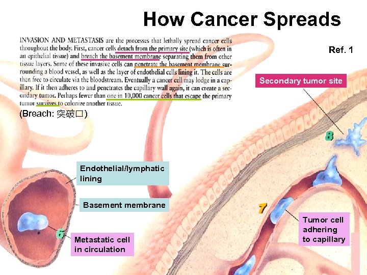 How Cancer Spreads Ref. 1 Secondary tumor site (Breach: 突破口) Endothelial/lymphatic lining Basement membrane