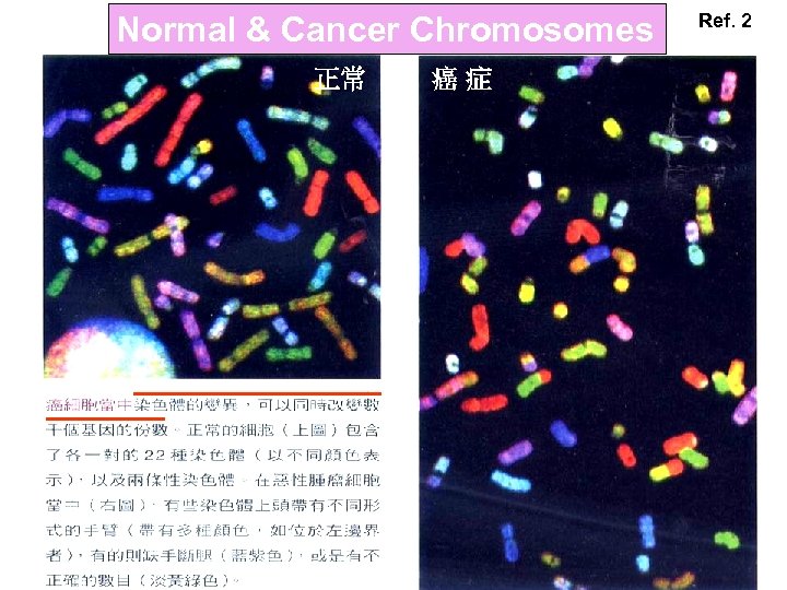 Normal & Cancer Chromosomes 正常 癌症 Ref. 2 