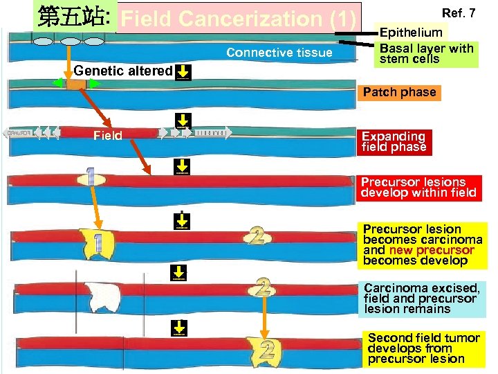 第五站: Field Cancerization (1) Connective tissue Genetic altered Ref. 7 Epithelium Basal layer with