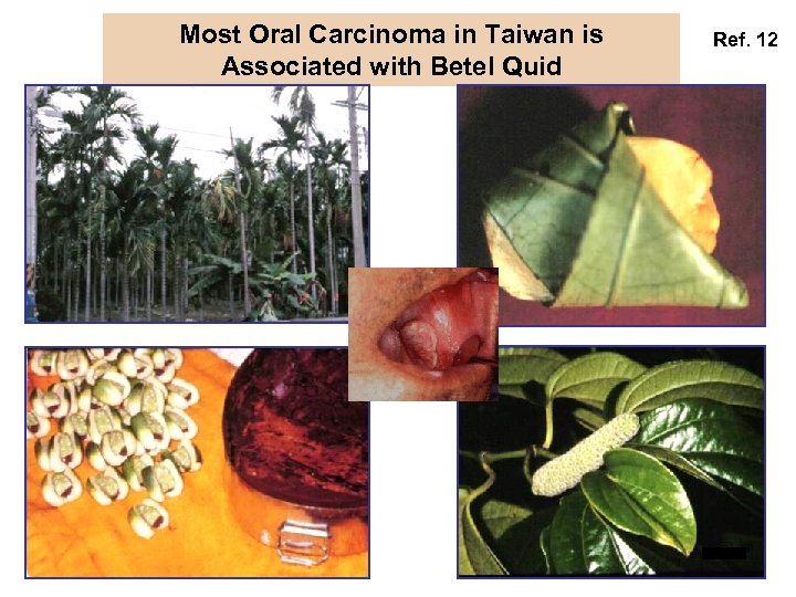 Most Oral Carcinoma in Taiwan is Associated with Betel Quid Ref. 12 