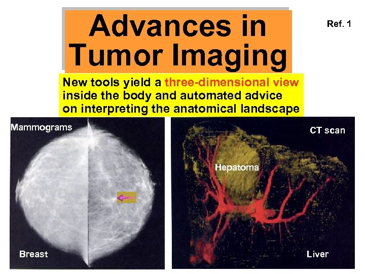 Advances in Tumor Imaging Ref. 1 New tools yield a three-dimensional view inside the