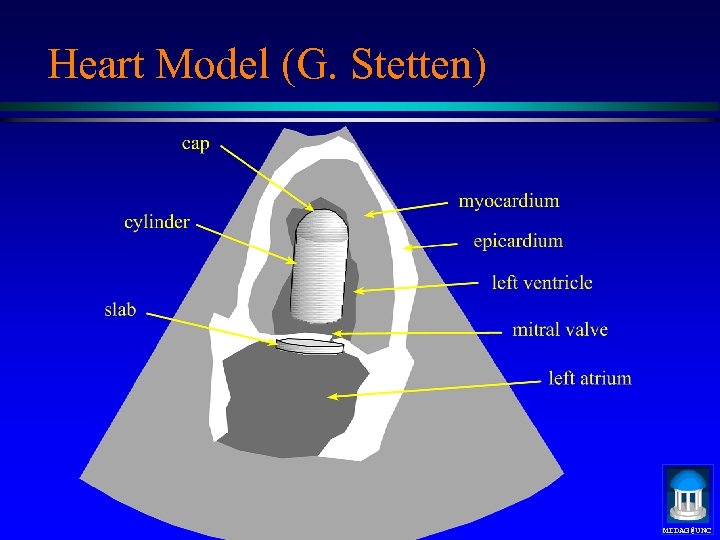 Heart Model (G. Stetten) MIDAG@UNC 