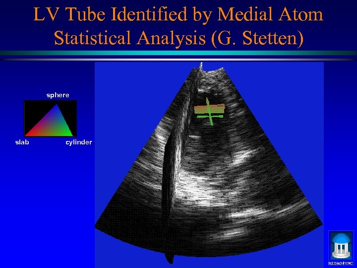 LV Tube Identified by Medial Atom Statistical Analysis (G. Stetten) sphere slab cylinder MIDAG@UNC