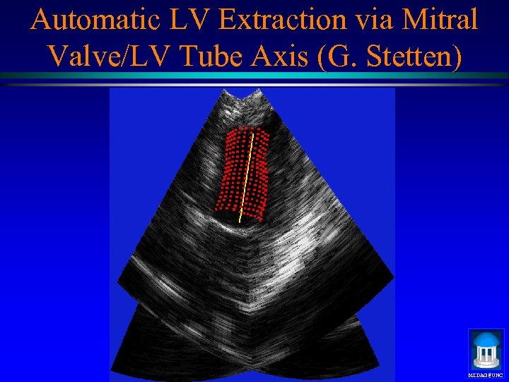 Automatic LV Extraction via Mitral Valve/LV Tube Axis (G. Stetten) MIDAG@UNC 