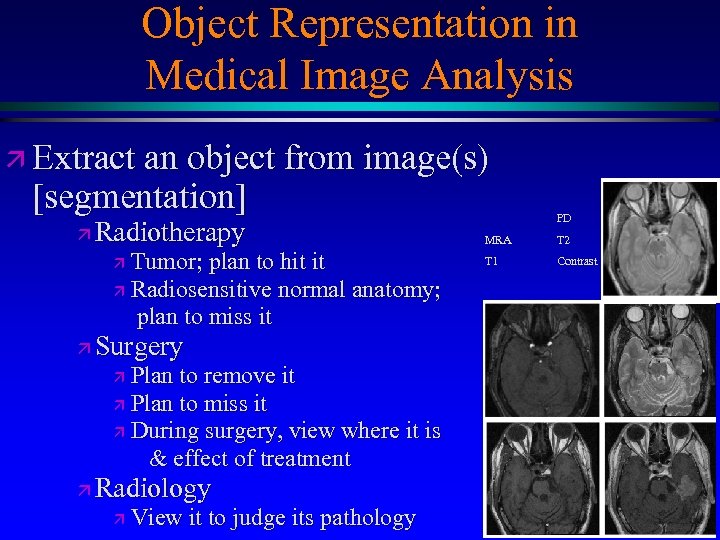 Object Representation in Medical Image Analysis ä Extract an object from image(s) [segmentation] ä