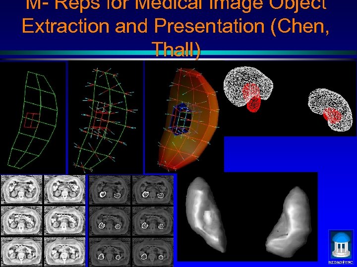 M- Reps for Medical Image Object Extraction and Presentation (Chen, Thall) MIDAG@UNC 