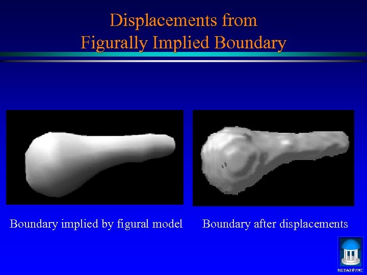 Displacements from Figurally Implied Boundary implied by figural model Boundary after displacements MIDAG@UNC 