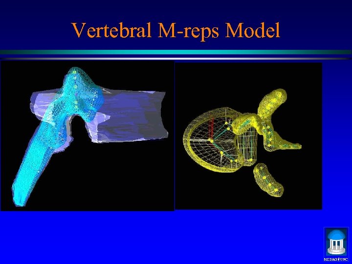 Vertebral M-reps Model MIDAG@UNC 