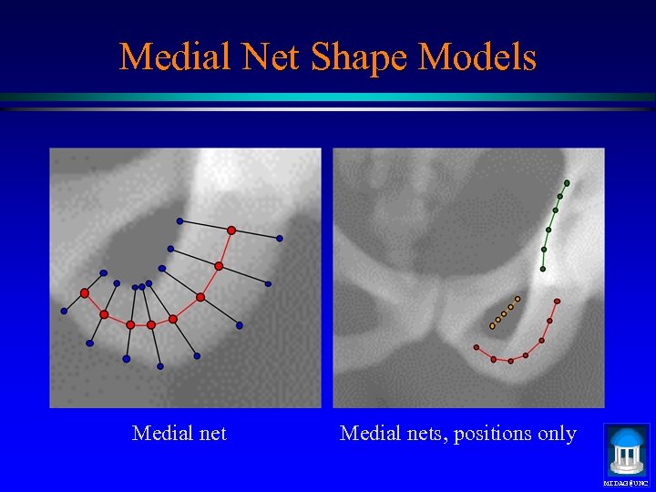 Medial Net Shape Models Medial nets, positions only MIDAG@UNC 