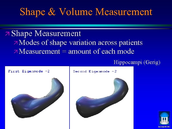 Shape & Volume Measurement ä Shape Measurement ä Modes of shape variation across patients