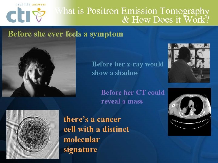 What is Positron Emission Tomography & How Does it Work? Before she ever feels