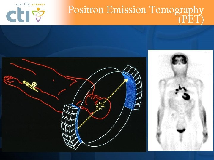 Positron Emission Tomography (PET) 