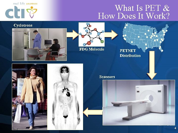 What Is PET & How Does It Work? Cyclotrons FDG Molecule PETNET Distribution Scanners
