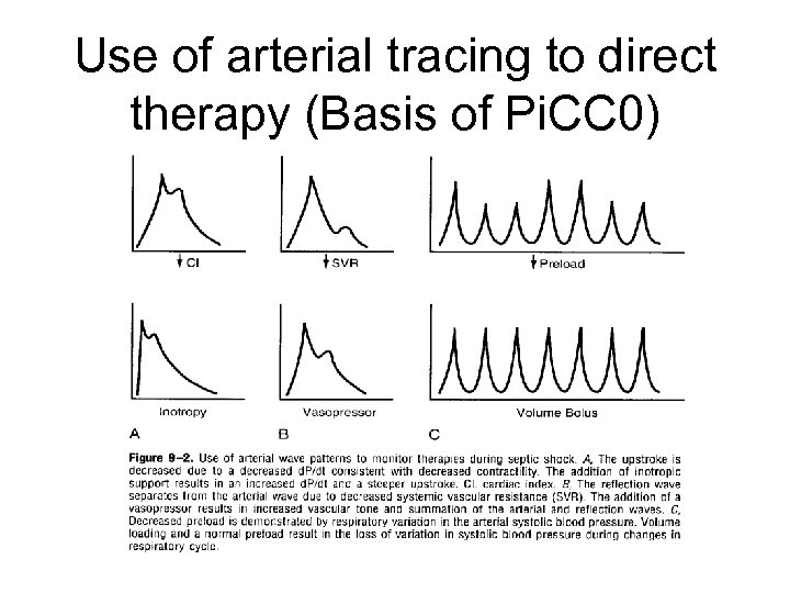 Use of arterial tracing to direct therapy (Basis of Pi. CC 0) 