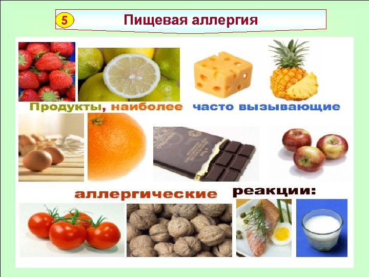 5 Пищевая аллергия 